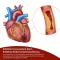 Kapsle Beh Artery+ (90 kusů)